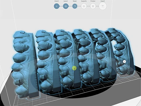 Digitale kieferorthopädische Design-Software