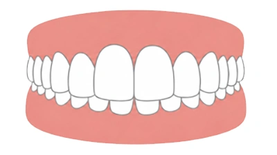 Tiefbiss (Overbite)