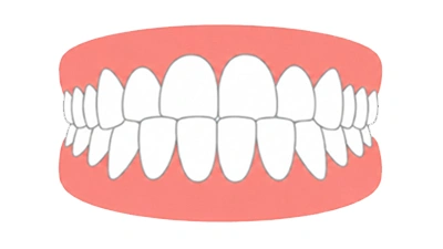 Vorbiss (Unterbiss)